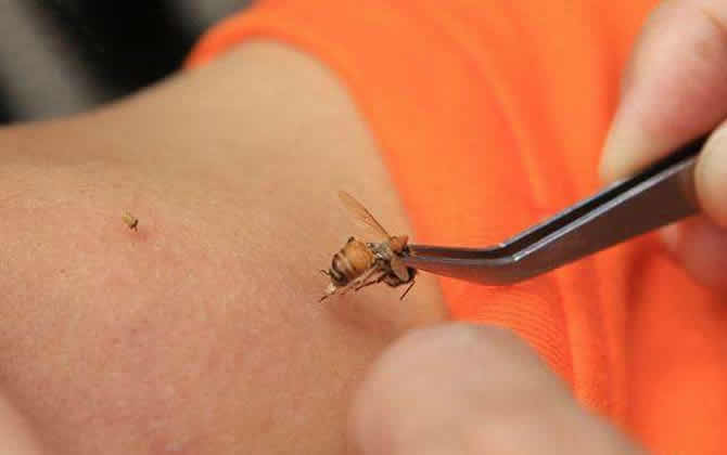 被蜜蜂蟄了怎么處理才好? 被蜜蜂蟄了