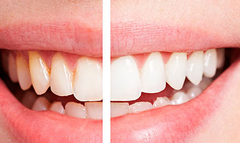 牙齒開(kāi)始“衰老”的三大癥狀，你可要當(dāng)心了