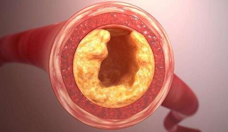 蜂蜜脂肪含量高嗎?蜂蜜中含有脂肪嗎?